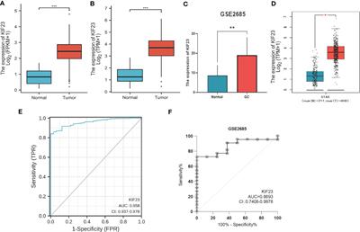 Diagnostic biomarker KIF23 is associated with immune infiltration and immunotherapy response in gastric cancer